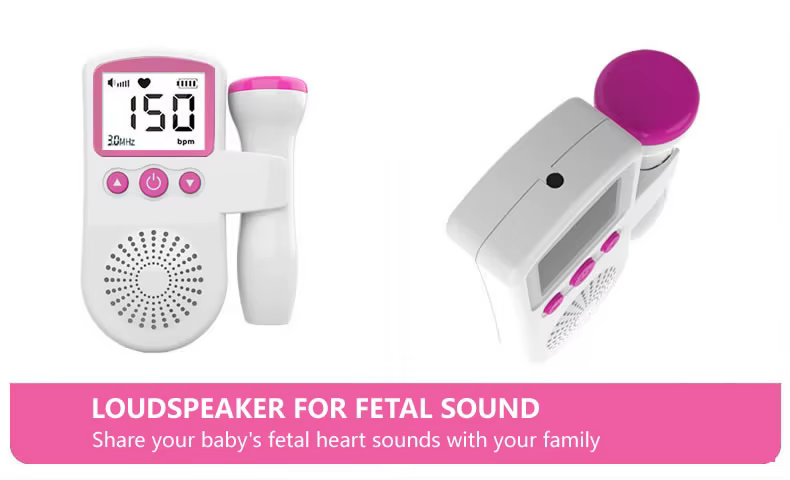 Prenatal Doppler