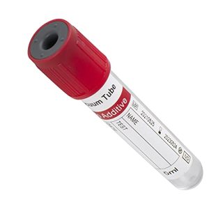 Red top vacutainer with clot activator