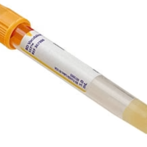 yellow vacutainer tube