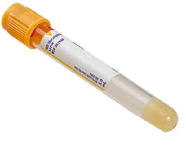 yellow vacutainer tube