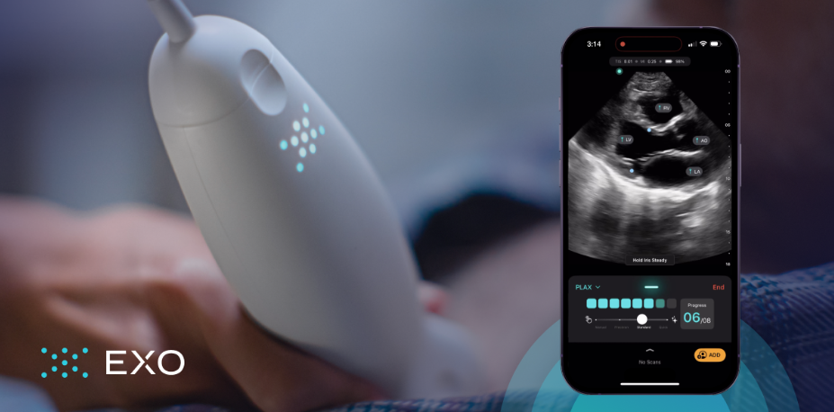 Pocus Ultrasound Machine - Image 3