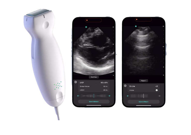 Pocus Ultrasound Machine - Image 4