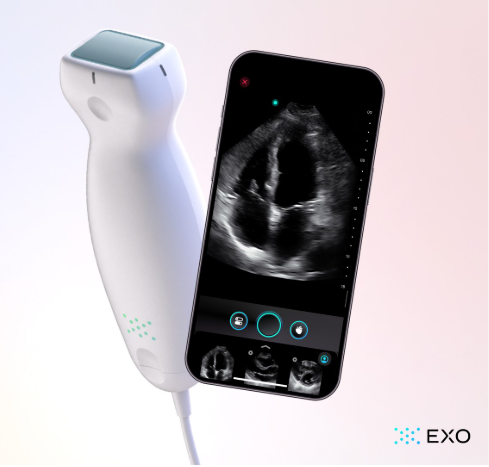 Pocus Ultrasound Machine