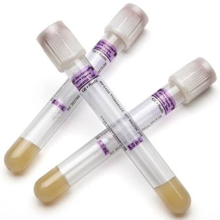 Plasma Preparation Tube